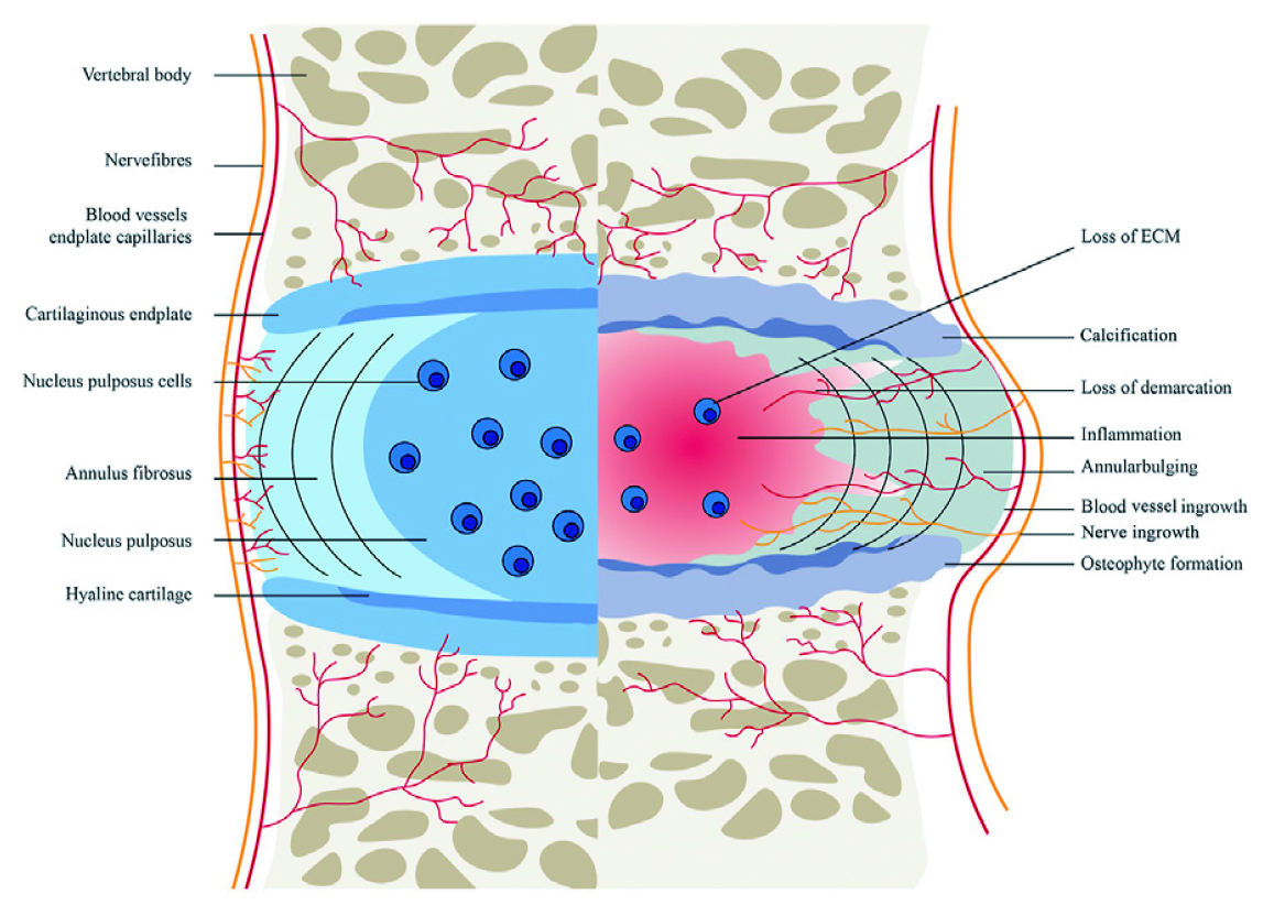 Nucleus Pulposus Cells